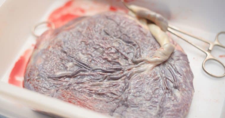 What are the benefits of Placenta Encapsulation?